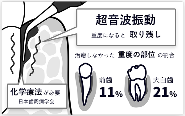 ブルーラジカル治療の仕組み